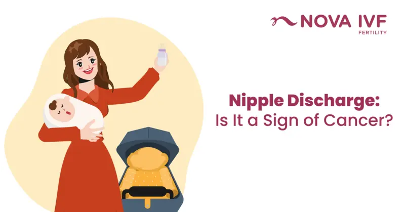  What Is Nipple Discharge? Types