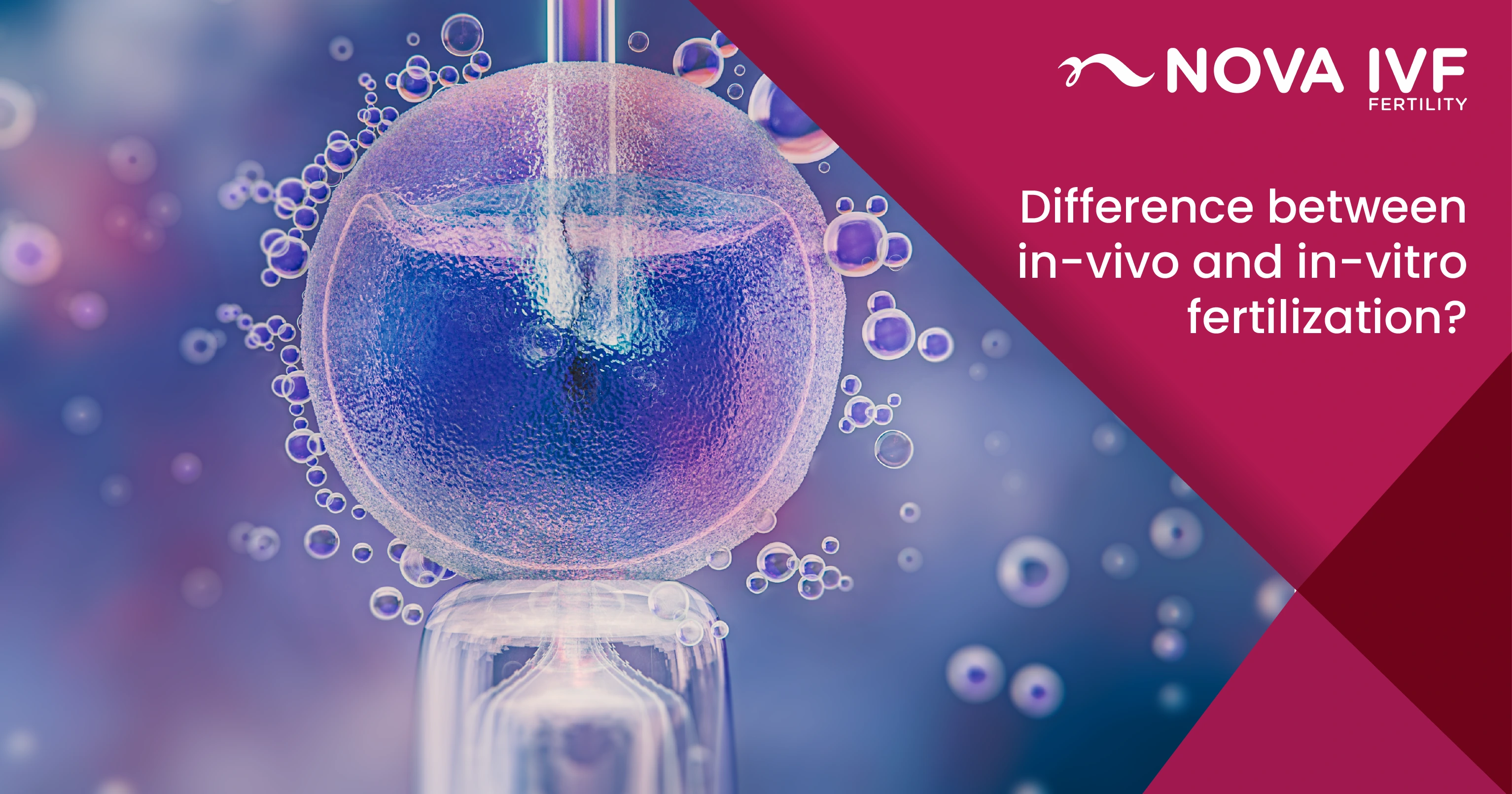  In Vivo vs. In Vitro Fertilization: Key Differences 