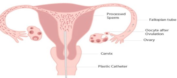 Female Reproductive System