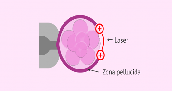 blastocyst