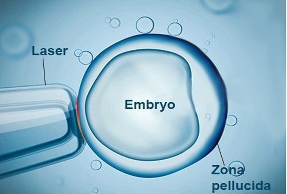 embryo transfer